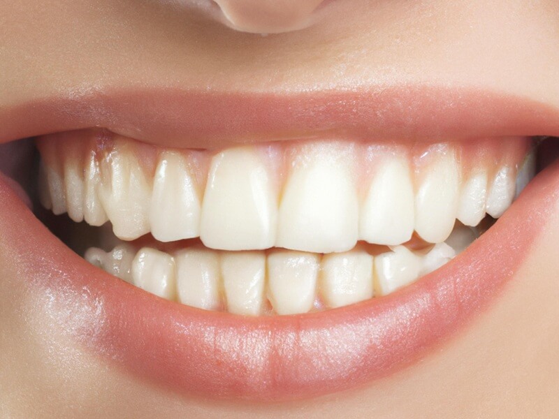 Cosmetic Dentistry